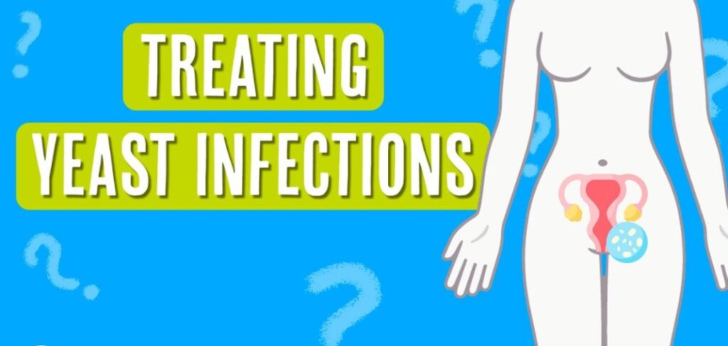 Vaginal Yeast Infection