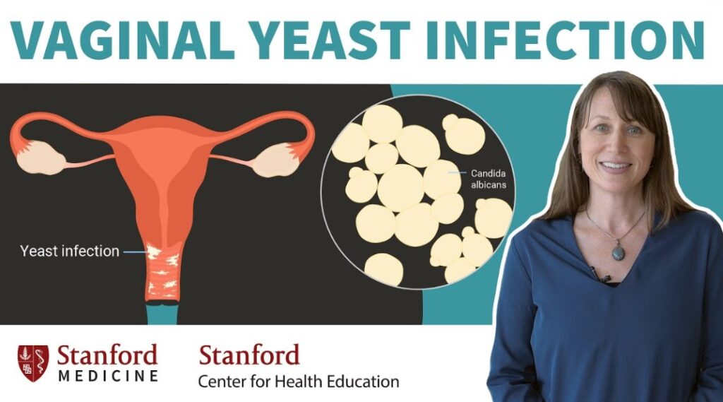 Vaginal Yeast Infection